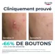 EUCERIN DermoPure Clinical - Triple Action Fluide triple correction 30ml - Illustration n°3