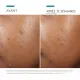 SKIN CEUTICALS Phyto A+ Brightening treatment - Illustration n°7