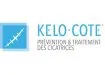 Kelo-Cote